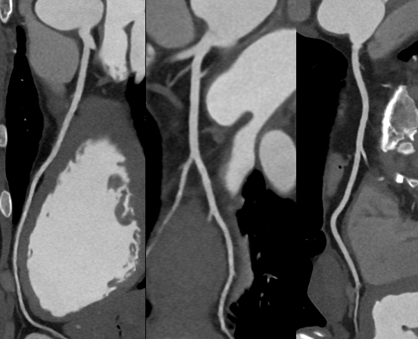 什么是联影ct真香预警？联影医疗双宽体双源CT大揭秘！TA竟然可以看到心脏的高清运动！_https://www.jmylbn.com_新闻资讯_第21张