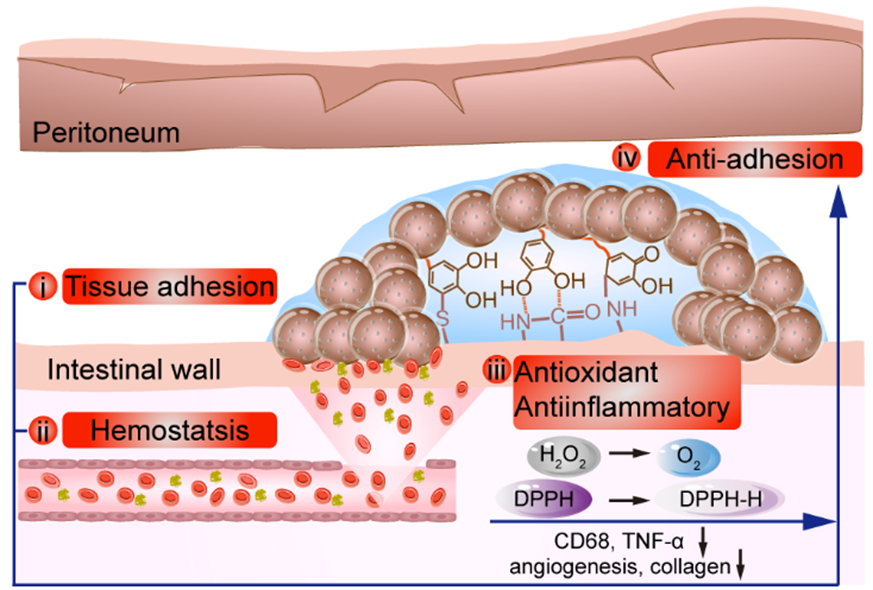 止血微球怎么用【复材资讯】喷涂式水凝胶微球通过止血和抗氧化预防术后组织粘连的发生_https://www.jmylbn.com_新闻资讯_第6张