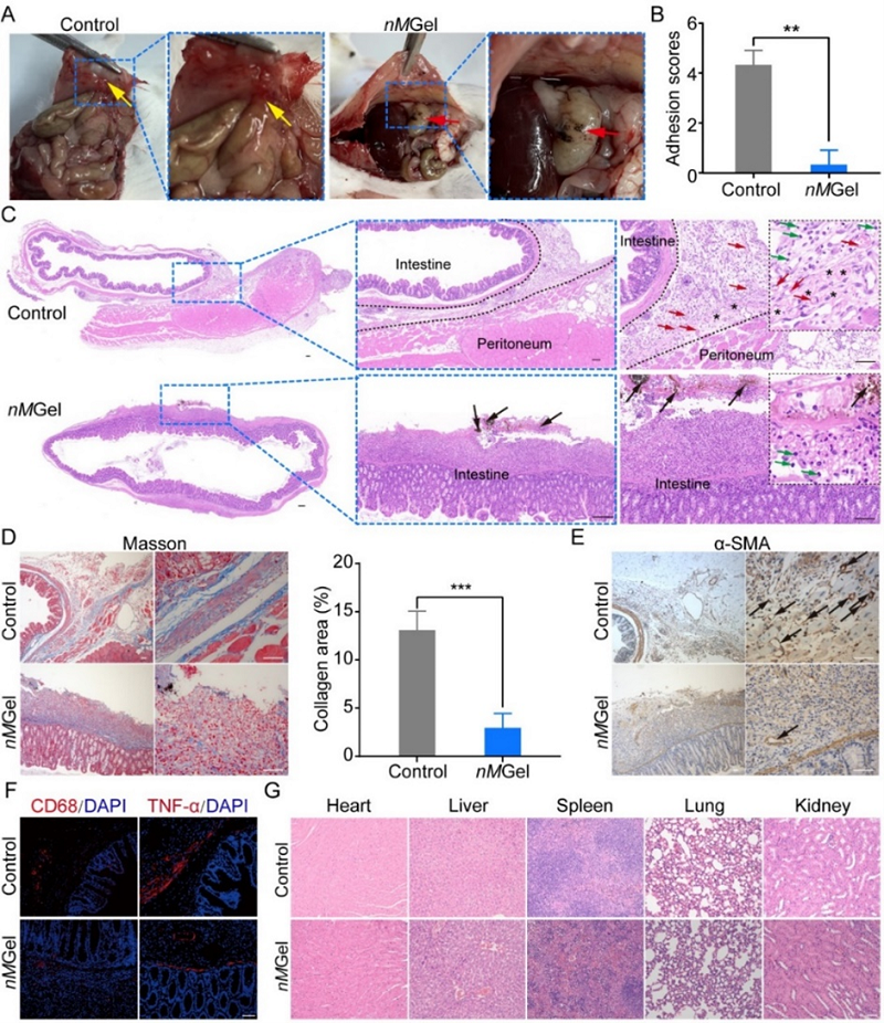 止血微球怎么用【复材资讯】喷涂式水凝胶微球通过止血和抗氧化预防术后组织粘连的发生_https://www.jmylbn.com_新闻资讯_第5张
