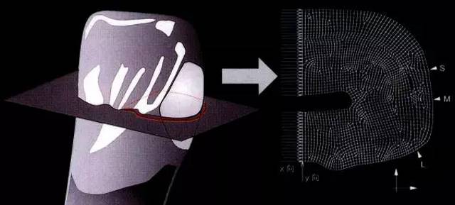 四种特殊贴面的预备方法