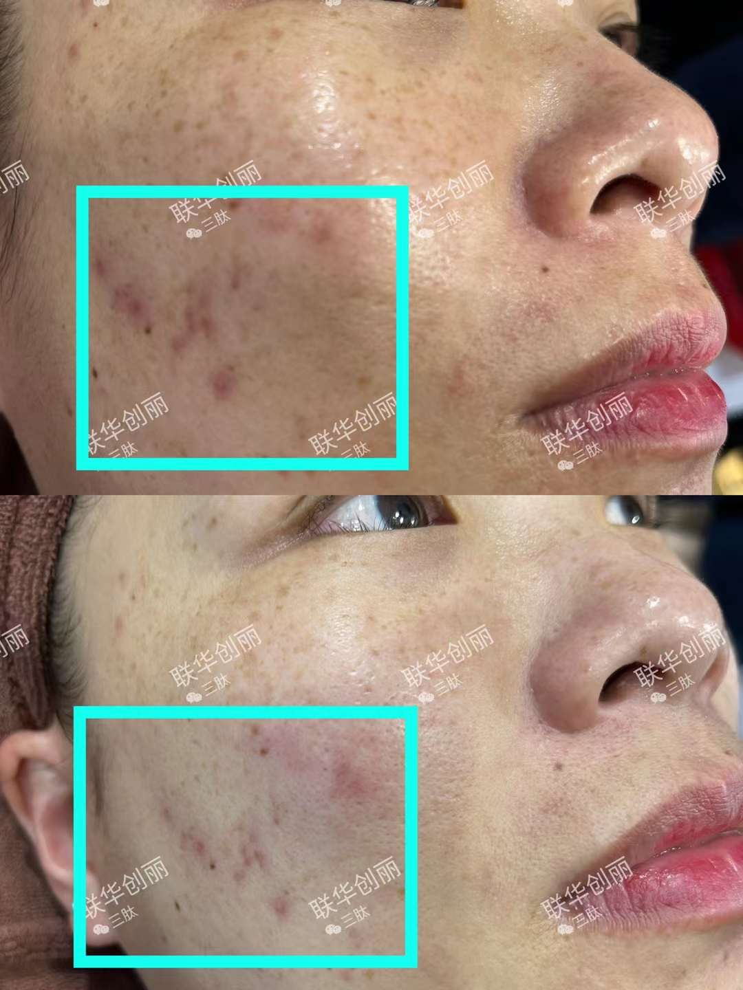 【水肽】为什么要做毛囊健康管理？