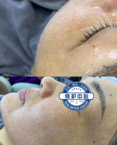 【水肽】为什么要坚持毛囊健康管理？