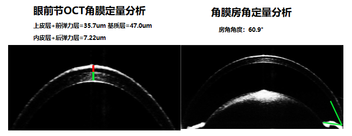 小眼科超顯微成像系統(tǒng)