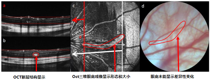 小眼科超顯微成像系統(tǒng)
