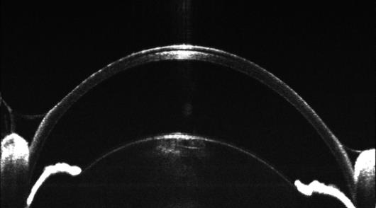 小眼科超顯微成像系統(tǒng)