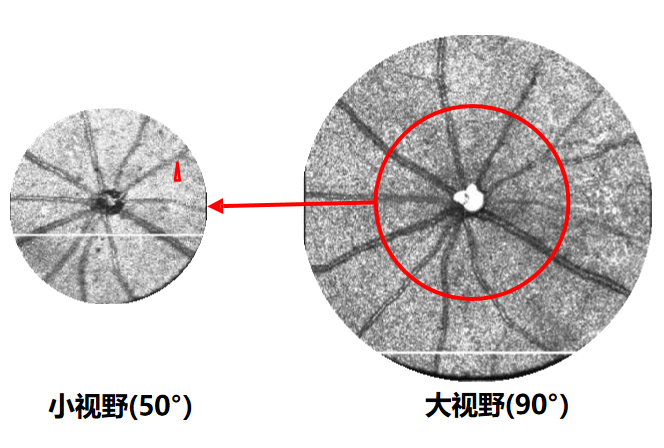 小眼科超顯微成像系統(tǒng)