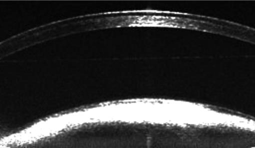 小眼科超顯微成像系統(tǒng)
