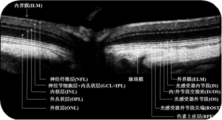 小眼科超顯微成像系統(tǒng)