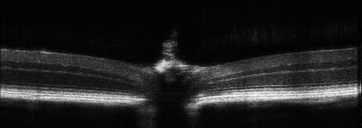 小眼科超顯微成像系統(tǒng)