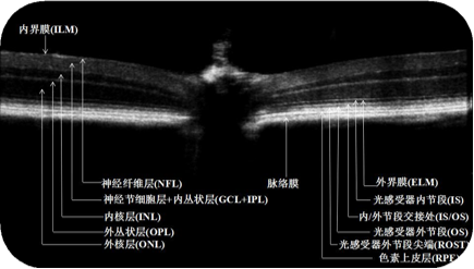 小眼科超顯微成像系統(tǒng)