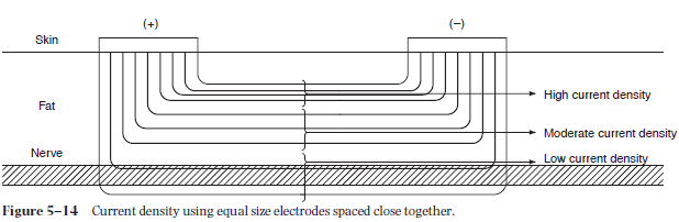 低频电刺激是什么科普｜低频之神经肌肉电刺激_https://www.jmylbn.com_新闻资讯_第17张