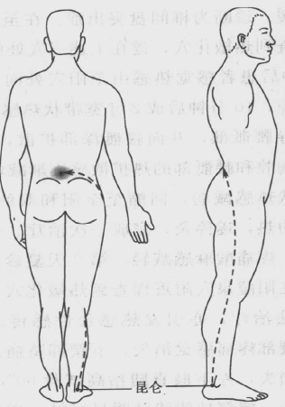 【病例分享】厲害了！不但解決了腰痛，還成功「瘦身了」突出的椎間盤！！ 未分類 第10張