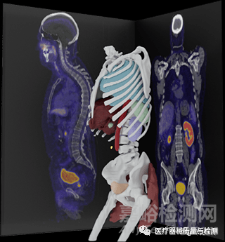 什么是创新医疗器械2021年最具创新性的24个医疗器械_https://www.jmylbn.com_新闻资讯_第19张