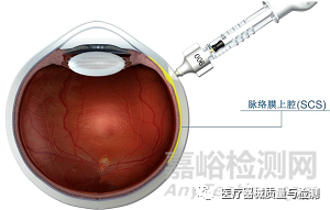什么是创新医疗器械2021年最具创新性的24个医疗器械_https://www.jmylbn.com_新闻资讯_第3张