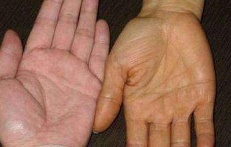 经常放屁是肝脏不好？频繁放屁的人，一般会有这3个习惯