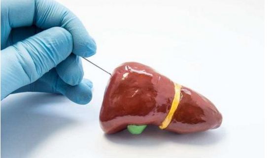 穿刺检查是什么意思 做肝穿刺活检有什么意义？带你来揭秘其5个作用！