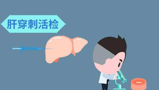 穿刺检查是啥意思_穿刺检查是什么意思_穿刺意思检查是抽血吗