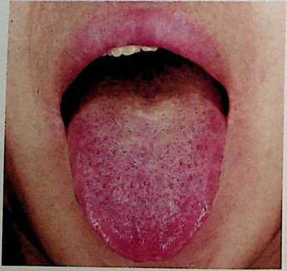 伸伸舌头百病消，看舌头自诊身体状况，太有用了！-古方玉灵膏-食疗补血妙方