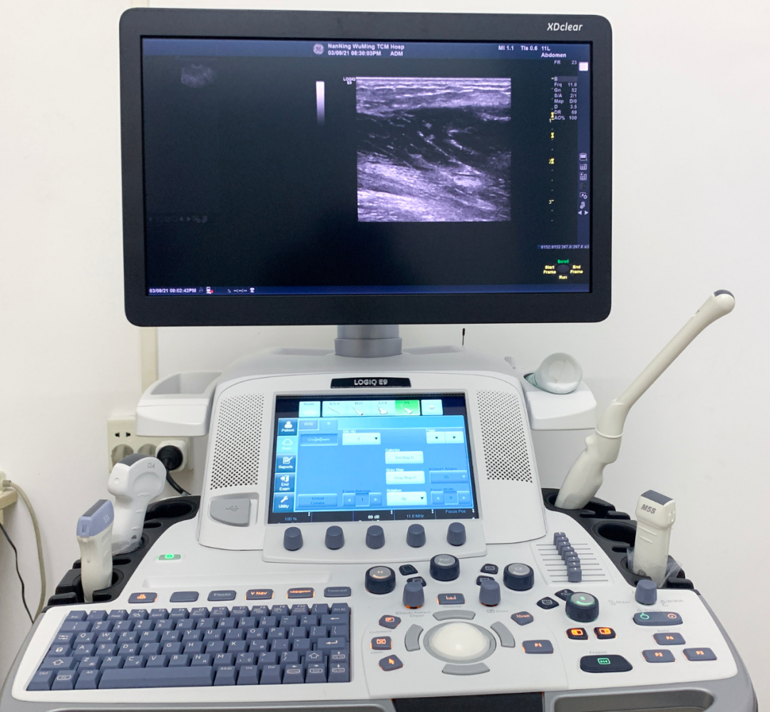 logiq e怎么读【普医先进设备介绍5】美国GE LOGIQ E9彩色超声诊断仪，临床诊疗出色的“侦察兵”_https://www.jmylbn.com_新闻资讯_第6张