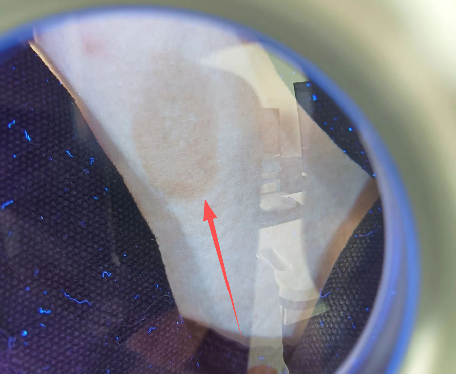 4006B光疗怎么用【新设备 新运用】治疗白癜风的308紫外线光疗仪哪里有？快来第十师北屯市总医院！_https://www.jmylbn.com_新闻资讯_第8张