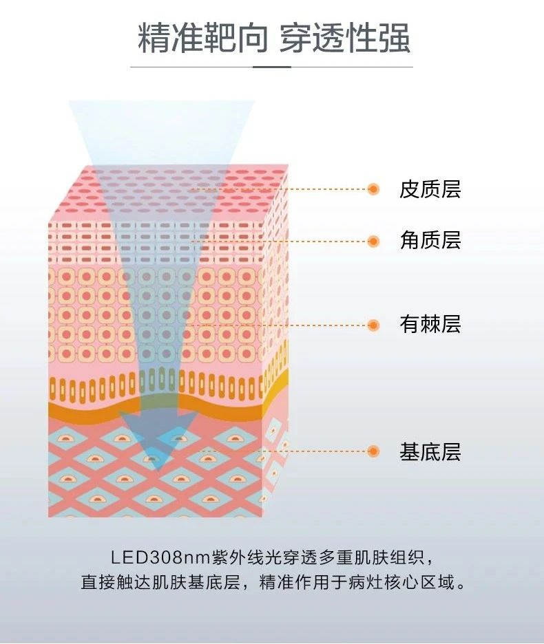 4006B光疗怎么用【新设备 新运用】治疗白癜风的308紫外线光疗仪哪里有？快来第十师北屯市总医院！_https://www.jmylbn.com_新闻资讯_第11张