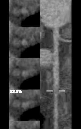 ge ct有哪些型号不怕超重 自由呼吸 ｜ GE Revolution CT显神奇，实现完美冠脉CTA检查！_https://www.jmylbn.com_新闻资讯_第10张