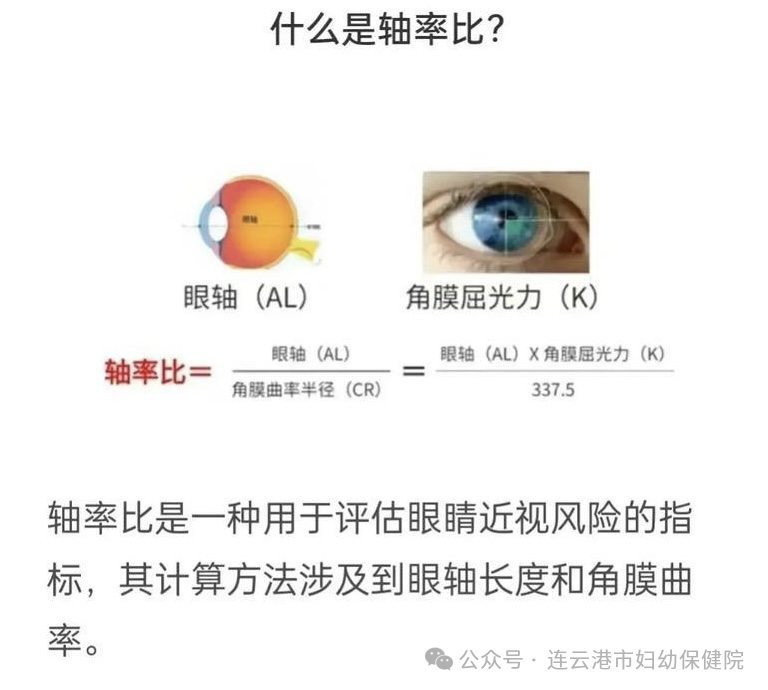 什么是轴率比.png