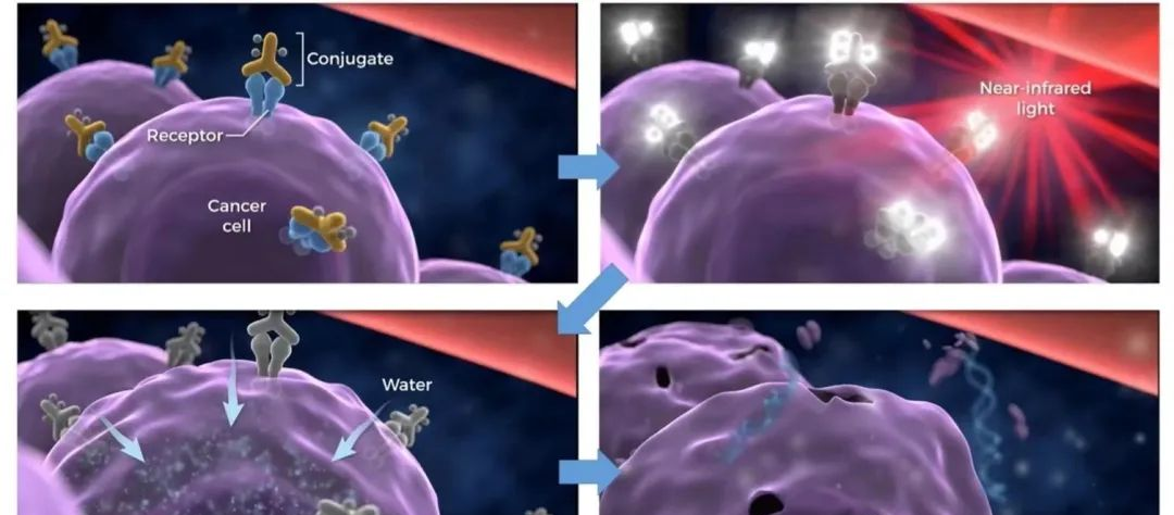 红外线理疗仪治什么病红外线治疗_https://www.jmylbn.com_新闻资讯_第2张