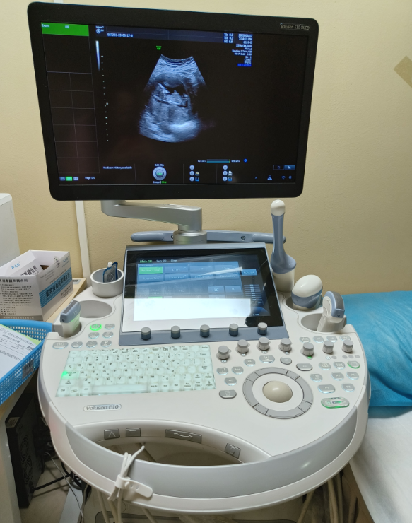 美国彩超怎么购买探索宝宝的世界：美国GE-E8四维彩超，大排畸“功臣”，预约免排队，赠送珍贵照片_https://www.jmylbn.com_新闻资讯_第5张