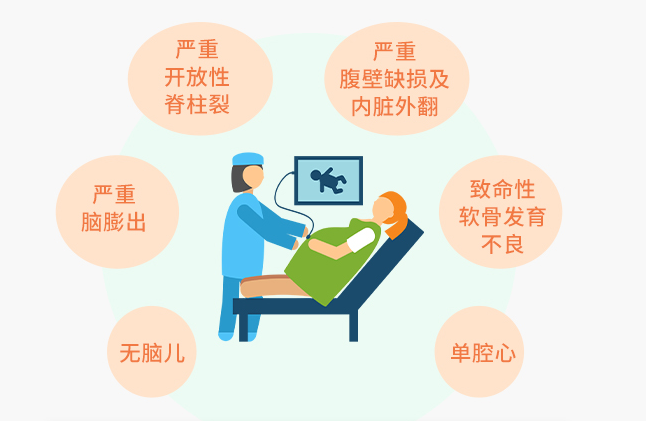 美国彩超怎么购买探索宝宝的世界：美国GE-E8四维彩超，大排畸“功臣”，预约免排队，赠送珍贵照片_https://www.jmylbn.com_新闻资讯_第3张