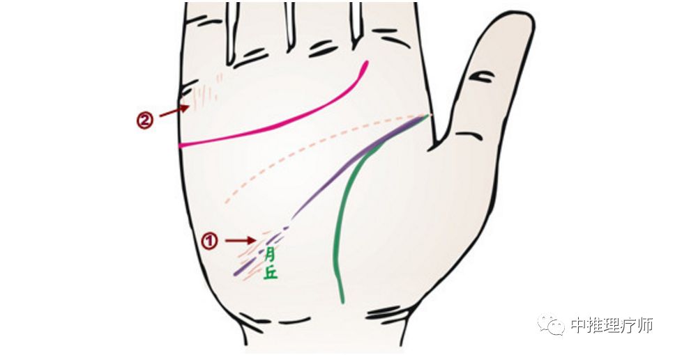 手相掌纹诊病 中推理疗师 微信公众号文章阅读 Wemp