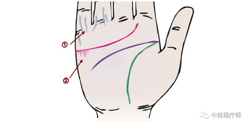 手相掌纹诊病 中推理疗师 微信公众号文章阅读 Wemp