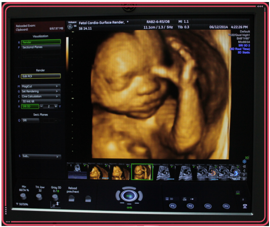 汕头彩超怎么样汕头澄海南方医院主要技术优势_https://www.jmylbn.com_新闻资讯_第9张