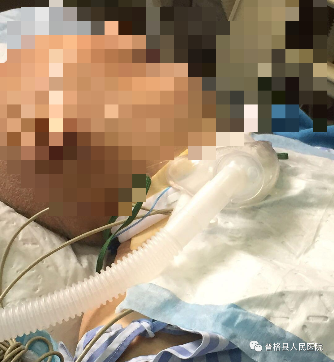 热湿装置怎么安装高流量加温加湿持续吸氧_https://www.jmylbn.com_新闻资讯_第4张