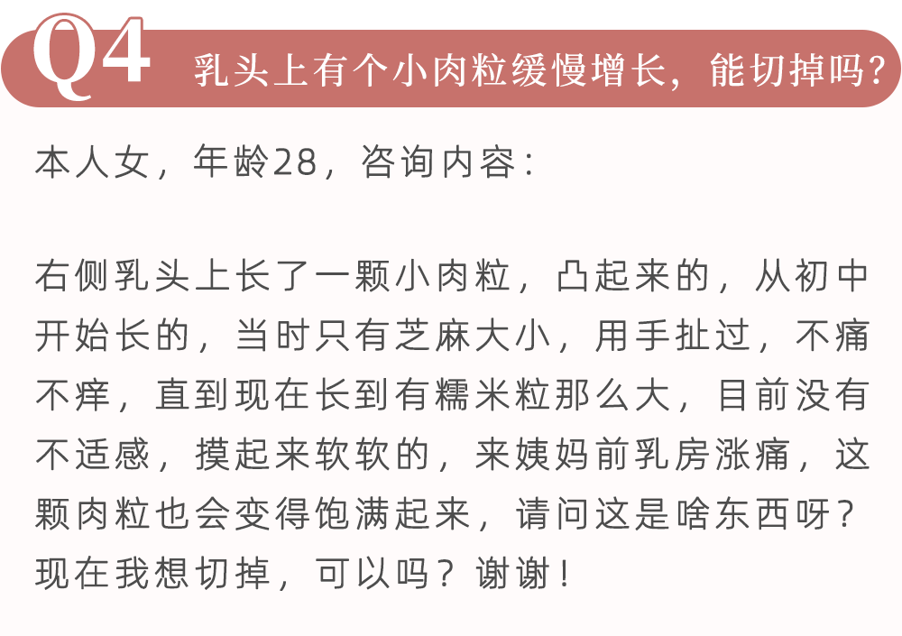 長痣,增生,結節,纖維瘤……女性乳房常見問題全解答 - 第十一診室