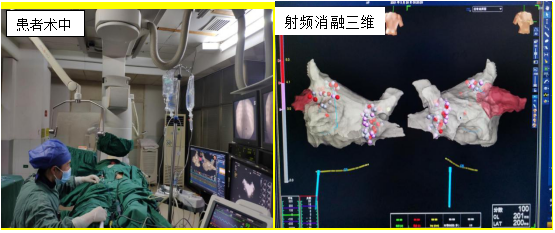 市中心医院圆满完成心腔内超声房颤“一站式”手术_邵阳头条网