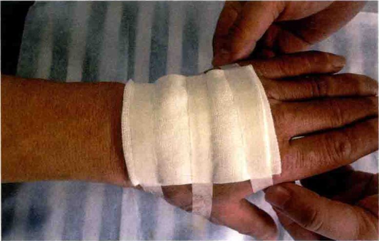 无菌敷料怎么用【图说】外科换药流程-感控操作图解_https://www.jmylbn.com_新闻资讯_第18张