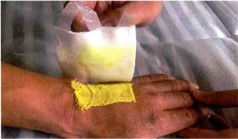 无菌敷料怎么用【图说】外科换药流程-感控操作图解_https://www.jmylbn.com_新闻资讯_第8张