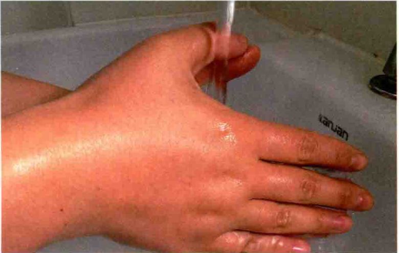 无菌敷料怎么用【图说】外科换药流程-感控操作图解_https://www.jmylbn.com_新闻资讯_第6张