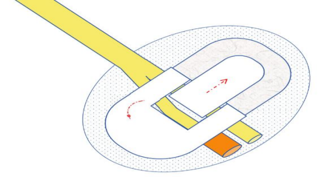 尿液引流袋怎么用留置尿管患者回家后滑脱怎么办，如何防感染？这里有居家护理妙招_https://www.jmylbn.com_新闻资讯_第4张