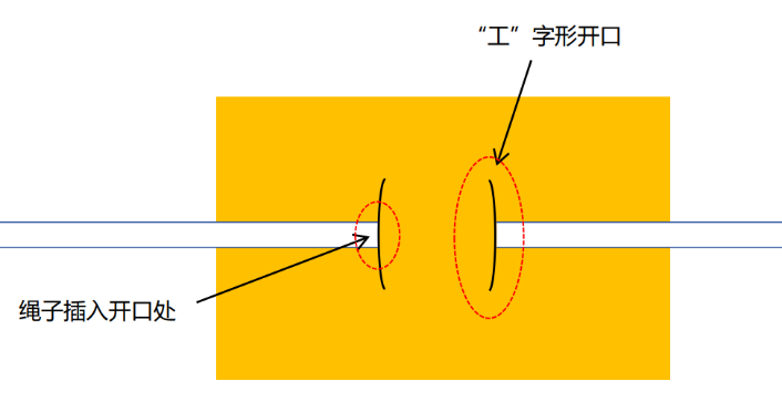 尿液引流袋怎么用留置尿管患者回家后滑脱怎么办，如何防感染？这里有居家护理妙招_https://www.jmylbn.com_新闻资讯_第3张