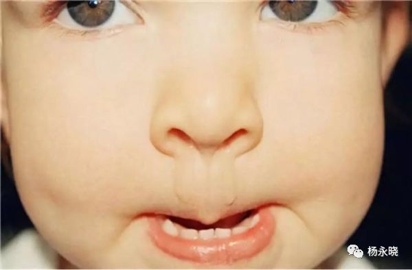 疫情之下，如何选择中成药，居家治疗感冒