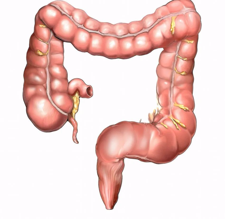 春季气温反常,如大便出现2种情况,要警惕一种肠道癌症-友友