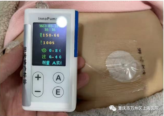 医疗泵什么医疗科普｜｜胰岛素泵_https://www.jmylbn.com_新闻资讯_第2张