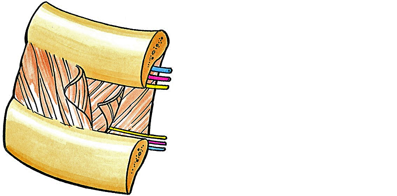 动脉钳怎么用复苏性开胸术_https://www.jmylbn.com_新闻资讯_第2张