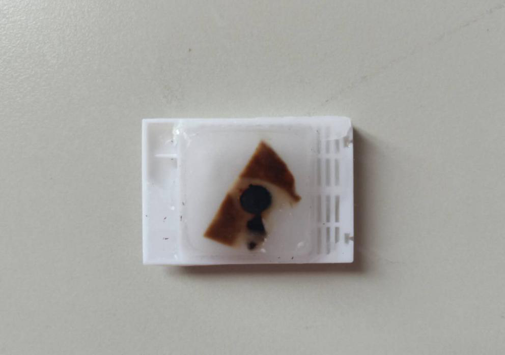 什么是病理蜡块范医•科普 ｜ 病理科的蜡块到底是什么_https://www.jmylbn.com_新闻资讯_第2张