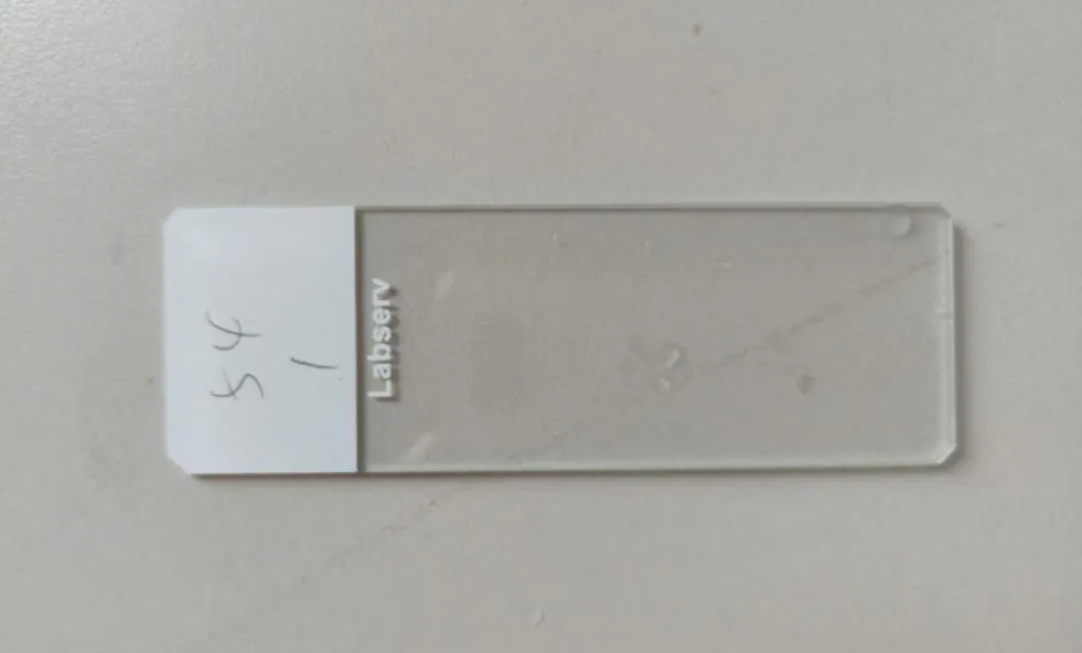 什么是病理蜡块范医•科普 ｜ 病理科的蜡块到底是什么_https://www.jmylbn.com_新闻资讯_第4张