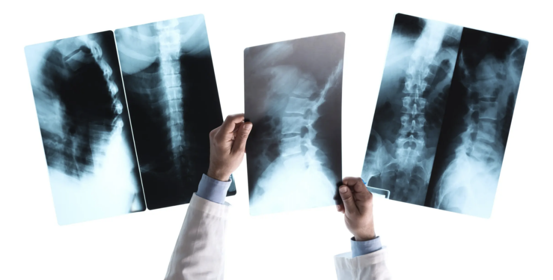 胃造影用的是什么机子【科普园地】胃肠机透视胃肠道病变，影像科创新技术助力健康_https://www.jmylbn.com_新闻资讯_第8张