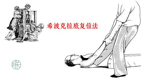 我们现在,今天所用的肩关节复位的方法,也叫作hippocrates法.