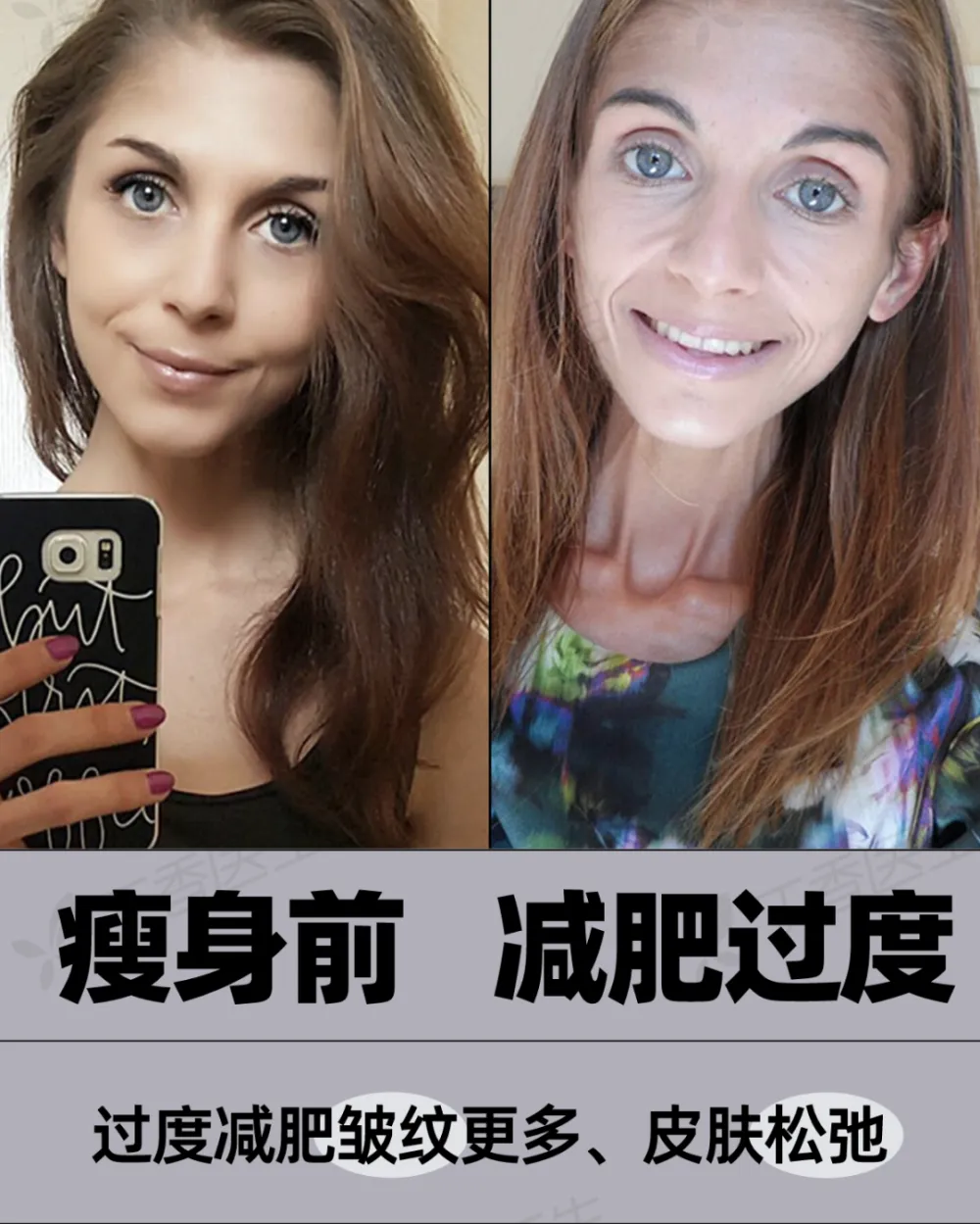一年瘦了30斤的面部变化